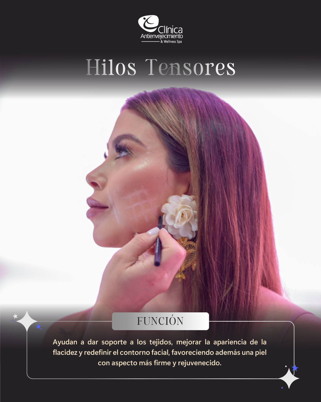 Hilos Tensores en Medellín — Clínica Antienvejecimiento